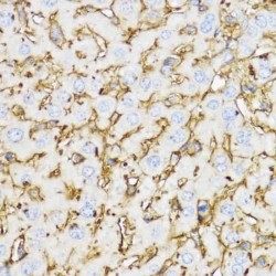 Chitinase-3-Like Protein 1 (CHI3L1) Antibody