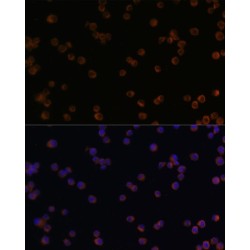 Chitinase-3-Like Protein 1 (CHI3L1) Antibody