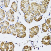 Immunohistochemistry of paraffin-embedded Human stomach using HDAC6 Antibody (1/100 dilution, 40x lens).