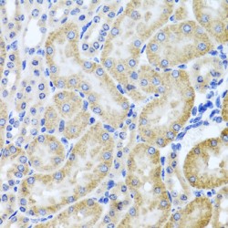 Histone Deacetylase 6 (HDAC6) Antibody
