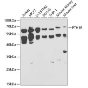 Western blot analysis of extracts of various cell lines using PTH1R Antibody (1/1000 dilution).