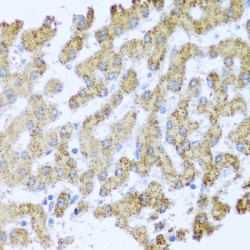 MAPK/MAK/MRK Overlapping Kinase (MOK) Antibody