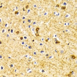 Myc Box-Dependent-Interacting Protein 1 (BIN1) Antibody