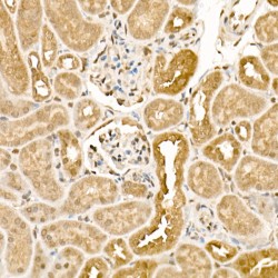 Casein Kinase I Isoform Epsilon (CSNK1E) Antibody