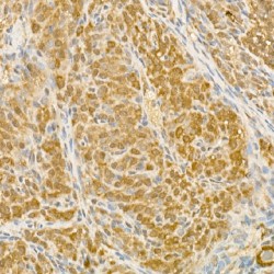 Casein Kinase I Isoform Epsilon (CSNK1E) Antibody