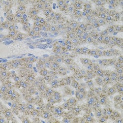 Vasoactive Intestinal Peptide (VIP) Antibody
