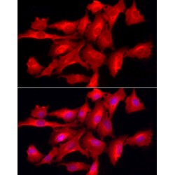 Protein Tyrosine Phosphatase, Non Receptor Type 2 (PTPN2) Antibody