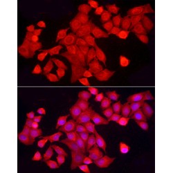 Protein Tyrosine Phosphatase, Non Receptor Type 2 (PTPN2) Antibody