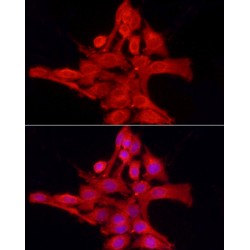 Protein Tyrosine Phosphatase, Non Receptor Type 2 (PTPN2) Antibody