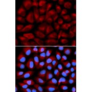 abx001499