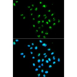 Eukaryotic Translation Initiation Factor 6 (EIF6) Antibody