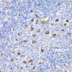 Prosaposin (PSAP) Antibody