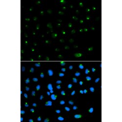 Prosaposin (PSAP) Antibody