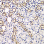Immunohistochemistry of paraffin-embedded Rat kidney using KEAP1 Antibody (1/100 dilution, 40x lens).
