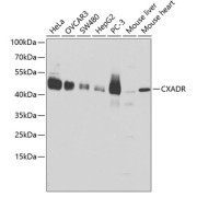 abx001505