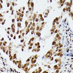 Heterogeneous Nuclear Ribonucleoprotein D (HNRNPD) Antibody