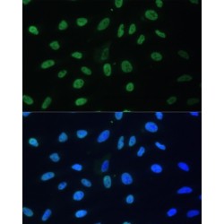 Heterogeneous Nuclear Ribonucleoprotein D (HNRNPD) Antibody