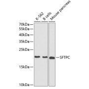 Western blot analysis of extracts of various cell lines using SFTPC Antibody (1/1000 dilution).
