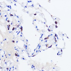 Pulmonary Surfactant-Associated Protein C (SFTPC) Antibody