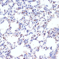 Pulmonary Surfactant-Associated Protein C (SFTPC) Antibody