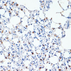 Pulmonary Surfactant-Associated Protein C (SFTPC) Antibody