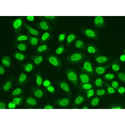 RNA Polymerase II Subunit J (POLR2J) Antibody