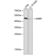 Western blot analysis of extracts of various cell lines using AMBP Antibody (1/1000 dilution).