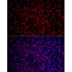 Arginase 1 (ARG1) Antibody
