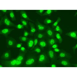 DNA Ligase 1 (LIG1) Antibody