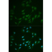 Immunofluorescence analysis of MCF-7 cells using LIG1 Antibody