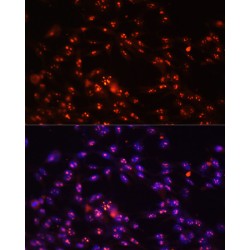 H/ACA Ribonucleoprotein Complex Subunit DKC1 (DKC1) Antibody