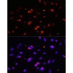 H/ACA Ribonucleoprotein Complex Subunit DKC1 (DKC1) Antibody