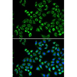 Complement C1q Binding Protein (C1QBP) Antibody