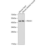 Western blot analysis of extracts of various cell lines using PDHA1 Antibody (1/1000 dilution).