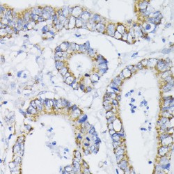 Pyruvate Dehydrogenase E1 Component Subunit Alpha, Somatic Form, Mitochondrial (PDHA1) Antibody
