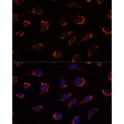 Pyruvate Dehydrogenase E1 Component Subunit Alpha, Somatic Form, Mitochondrial (PDHA1) Antibody