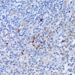 Peptidyl Arginine Deiminase Type IV (PADI4) Antibody