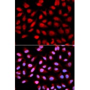 Immunofluorescence analysis of U2OS cells using Ser/thr-PP2A activator (PTPA) Antibody Blue: DAPI for nuclear staining.