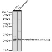 Western blot analysis of extracts of various cell lines using Peroxiredoxin 2 Antibody (1/1000 dilution).