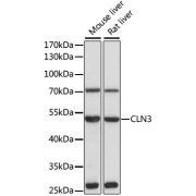 Western blot analysis of extracts of various cell lines using CLN3 Antibody (1/1000 dilution).
