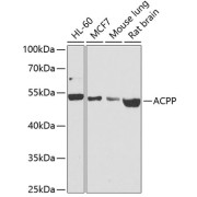 abx001583
