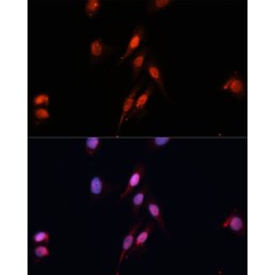 Mothers Against Decapentaplegic Homolog 5 (SMAD5) Antibody