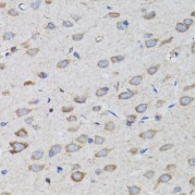 Immunohistochemistry of paraffin-embedded Rat brain using PSMD10 Antibody (1/100 dilution, 40x lens).