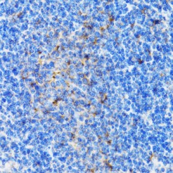 26S Proteasome Non-ATPase Regulatory Subunit 10 (PSMD10) Antibody