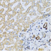 Immunohistochemistry of paraffin-embedded Human liver using CSH1 Antibody (1/100 dilution, 40x lens).