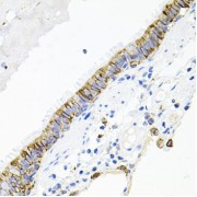 Immunohistochemistry of paraffin-embedded Human lung using ACVR2A Antibody (1/100 dilution, 40x lens).