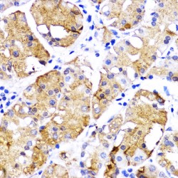 Bone Morphogenetic Protein Receptor 1B (BMPR1B) Antibody