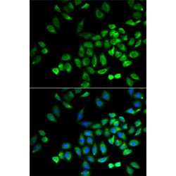 Angiopoietin-Related Protein 4 (ANGPTL4) Antibody