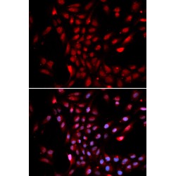 Importin Subunit Alpha-3 (KPNA4) Antibody