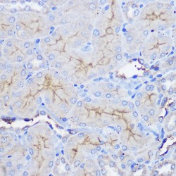 5'-Nucleotidase / CD73 (NT5E) Antibody